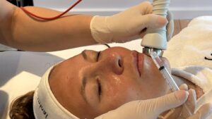 NIEUWS 1001 Pluryal Mesoline Clear & Exoyouth 01